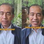 Diduga Diidap Jokowi, Sindrom Stevens Johnson Penyakit Kulit Berbahaya yang Bisa Mengancam Jiwa